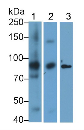 Polyclonal Antibody to Inhibitor Of Kappa-Light Polypeptide Gene Enhancer In B-Cells Kinase Beta (IkBKb)