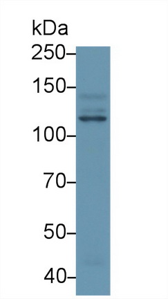 Polyclonal Antibody to Phosphoinositide-3-Kinase Catalytic Beta Polypeptide (PIK3Cb)