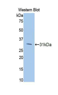 Polyclonal Antibody to Phosphoinositide-3-Kinase Catalytic Beta Polypeptide (PIK3Cb)