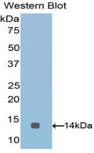 Polyclonal Antibody to V-Set Domain Containing T-Cell Activation Inhibitor 1 (VTCN1)