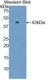 Polyclonal Antibody to V-Set Domain Containing T-Cell Activation Inhibitor 1 (VTCN1)