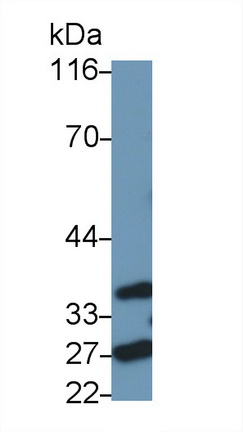 Polyclonal Antibody to Fas Associating Death Domain Containing Protein (FADD)