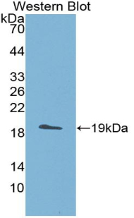 Polyclonal Antibody to A Disintegrin And Metalloproteinase With Thrombospondin 5 (ADAMTS5)