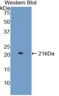 Polyclonal Antibody to A Disintegrin And Metalloproteinase With Thrombospondin 2 (ADAMTS2)