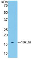 Polyclonal Antibody to Transmembrane Protein 27 (TMEM27)