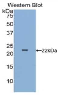 Polyclonal Antibody to Parkinson Disease Protein 7 (PARK7)