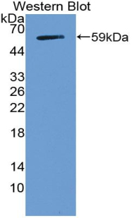 Polyclonal Antibody to Notch Homolog 3 (NOTCH3)