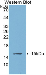 Polyclonal Antibody to Angiogenic Factor With G Patch And FHA Domains 1 (AGGF1)