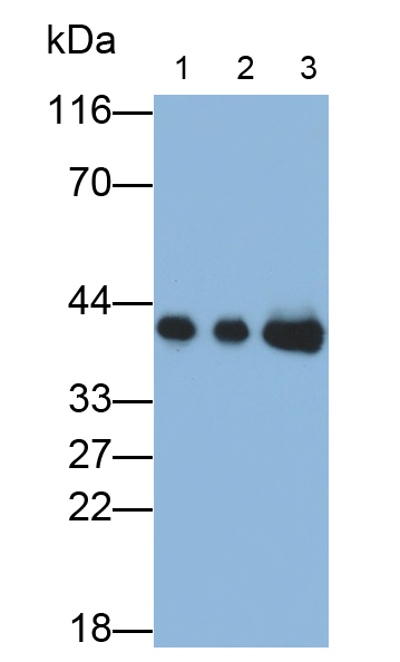 Polyclonal Antibody to Alpha-2-Glycoprotein 1, Zinc Binding (aZGP1)