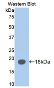 Biotin-Linked Polyclonal Antibody to Alpha-2-Glycoprotein 1, Zinc Binding (aZGP1)