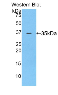 Polyclonal Antibody to Alpha-2-Glycoprotein 1, Zinc Binding (aZGP1)