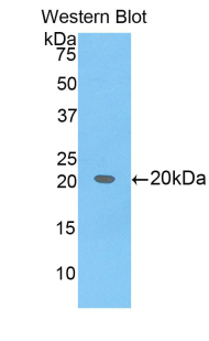 Polyclonal Antibody to B-Cell CLL/Lymphoma 2 Like Protein 2 (Bcl2L2)