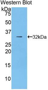 Polyclonal Antibody to CD2 Associated Protein (CD2AP)