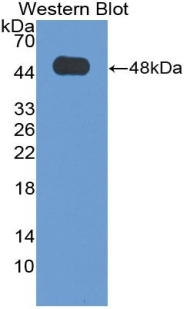 Polyclonal Antibody to Delta Like 1 Homolog (dLK1)