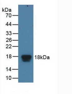 Polyclonal Antibody to Eukaryotic Translation Initiation Factor 4E Binding Protein 1 (EIF4EBP1)