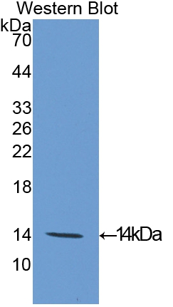 Polyclonal Antibody to Eukaryotic Translation Initiation Factor 4E Binding Protein 1 (EIF4EBP1)