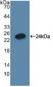 Polyclonal Antibody to Growth Arrest And DNA Damage Inducible Protein Alpha (GADD45a)