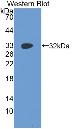 Polyclonal Antibody to Insulin Like Growth Factor 2 mRNA Binding Protein 2 (IGF2BP2)