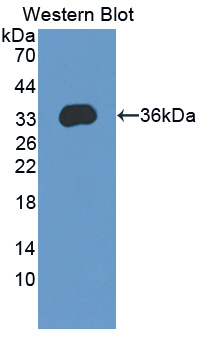 Polyclonal Antibody to KH Domain Containing, RNA Binding, Signal Transduction Associated Protein 1 (KHDRBS1)