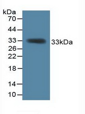 Polyclonal Antibody to KH Domain Containing, RNA Binding, Signal Transduction Associated Protein 1 (KHDRBS1)