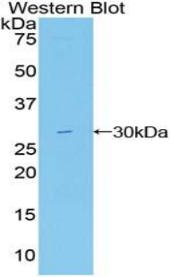 Polyclonal Antibody to Mindbomb Homolog 2 (MIB2)