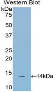 Polyclonal Antibody to Semaphorin 3A (SEMA3A)