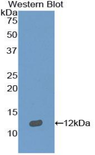 Polyclonal Antibody to Semaphorin 3E (SEMA3E)