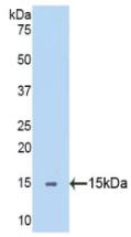 Polyclonal Antibody to Semaphorin 5B (SEMA5B)