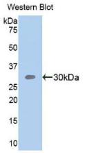 Polyclonal Antibody to Semaphorin 5B (SEMA5B)