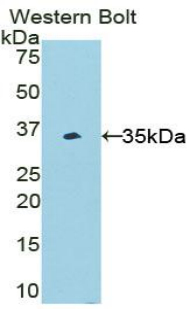 Polyclonal Antibody to PR Domain Containing Protein 1 (PRDM1)