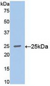 Polyclonal Antibody to V-Ral Simian Leukemia Viral Oncogene Homolog A (RALA)