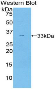 Polyclonal Antibody to Src Homology 2 Domain Containing Adapter Protein B (SHB)