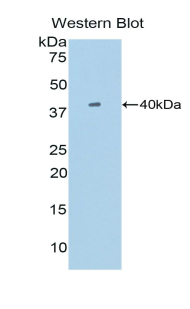 Polyclonal Antibody to Single Ig IL1 Related Receptor (SIGIRR)