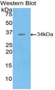 Polyclonal Antibody to Salt Inducible Kinase 2 (SIK2)