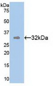 Polyclonal Antibody to Tomoregulin 1 (TR1)