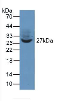 Polyclonal Antibody to Twinfilin 1 (TWF1)