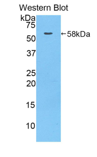 Polyclonal Antibody to Metastasis Associated In Colon Cancer 1 (MACC1)