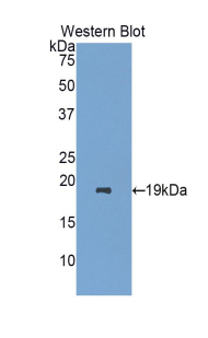 Polyclonal Antibody to Retinol Binding Protein 7, Cellular (RBP7)