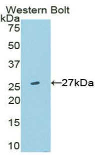 Polyclonal Antibody to Transmembrane Protein 173 (TMEM173)