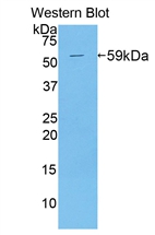 Polyclonal Antibody to Reprimo (RPRM)