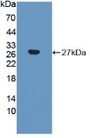 Polyclonal Antibody to Collagen Triple Helix Repeat Containing Protein 1 (CTHRC1)
