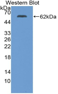 Biotin-Linked Polyclonal Antibody to Wingless Type MMTV Integration Site Family, Member 5A (WNT5A)