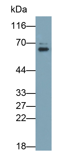 Polyclonal Antibody to RAD23 Homolog B (RAD23B)