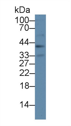 Polyclonal Antibody to Proteasome 26S Subunit, Non ATPase 8 (PSMD8)