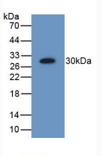 Polyclonal Antibody to Proteasome 26S Subunit, Non ATPase 9 (PSMD9)