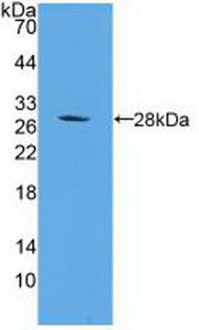 Polyclonal Antibody to Proteasome 26S Subunit, Non ATPase 10 (PSMD10)