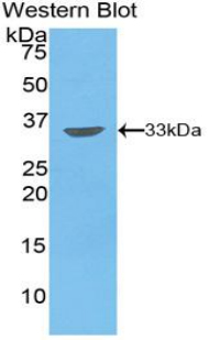 Polyclonal Antibody to Pim-2 Oncogene (PIM2)