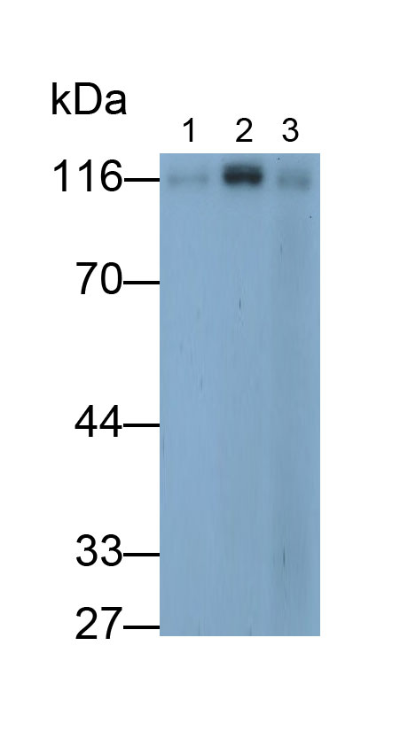 Polyclonal Antibody to Poly ADP Ribose Glycohydrolase (PARG)