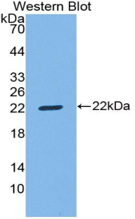 Polyclonal Antibody to Cluster Of Differentiation 8b (CD8b)