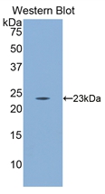 Polyclonal Antibody to Cluster Of Differentiation 8b (CD8b)